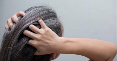 WellHealthOrganic.com: Know the Causes of White Hair and Easy Ways to Prevent It Naturally
